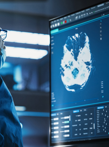 Brain scan displayed on medical monitor