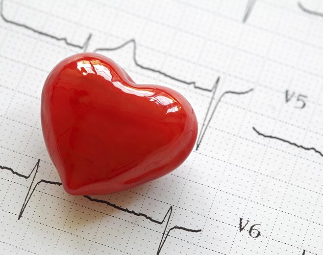 cardiology-heart-care-ekg/